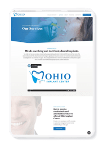 Ohio Implant Center Services Page